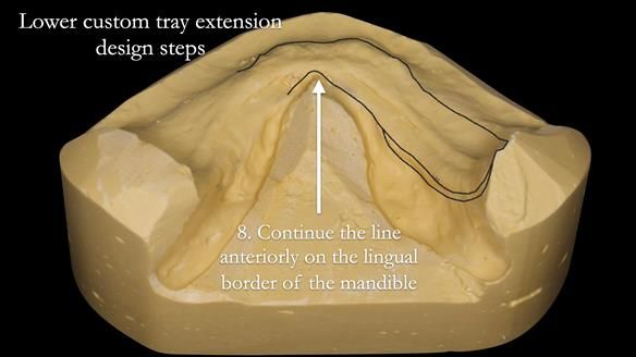 Newsletter 50 Special edition Complete Dentures FULL PROTOCOL