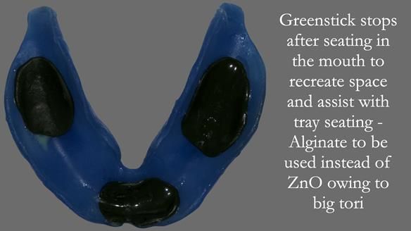 Newsletter 53 showing the making and fitting of ultra life-like dentures for Valena