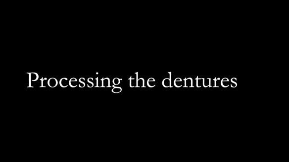 Newsletter 52 Managing Jo’s failing dentition with extractions and Mk 1/Mk 2 complete upper dentures and lower partial dentures FULL PROTOCOL
