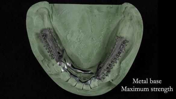 Ken – going downhill, first class