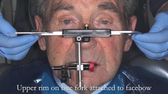 Newsletter 50 Special edition Complete Dentures FULL PROTOCOL