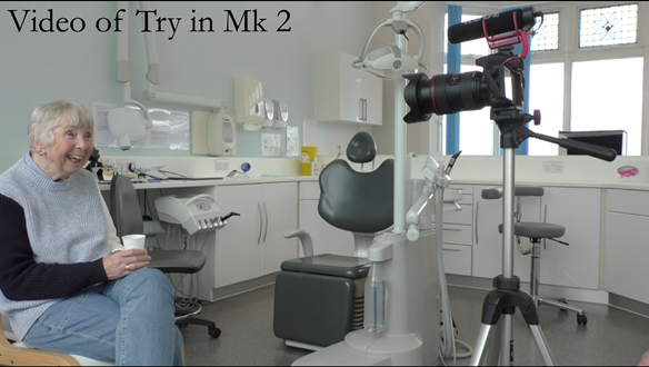 Figure 93 Video recording of the patient with Mk 2 try in - sipping cold water to minimise movement of teeth in wax
