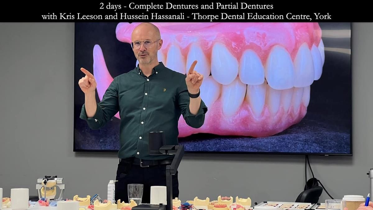 Finlay's Newsletter 59 Ultra hard partial dentures made for Gill