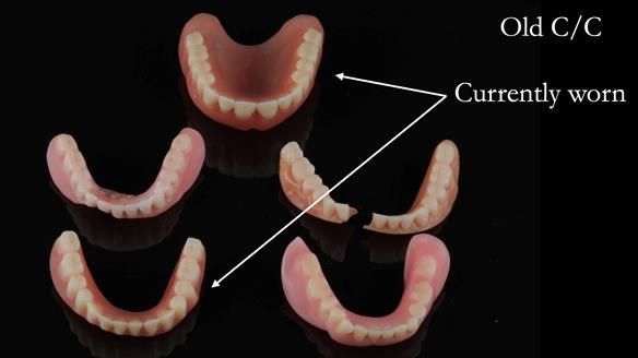 Newsletter 50 Special edition Complete Dentures FULL PROTOCOL