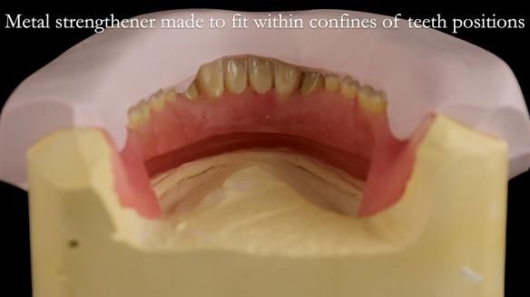 Newsletter 50 Special edition Complete Dentures FULL PROTOCOL