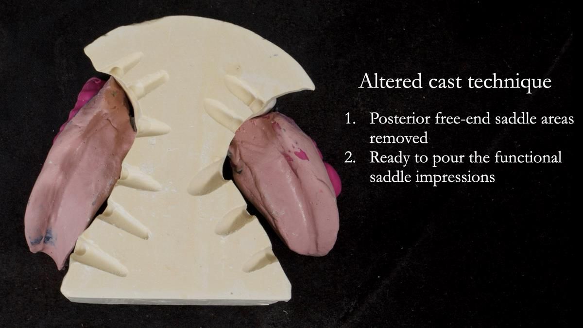 Newsletter 87 – Father Peter: A Partial Denture that needed Minor Miracle
