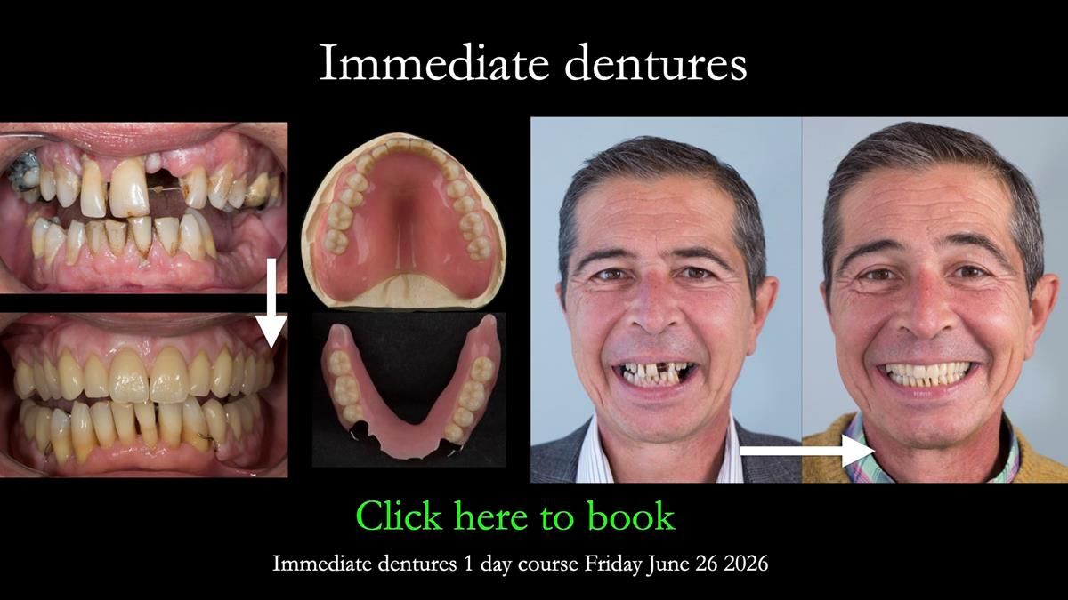 Newsletter 86 Peter the Architect — precision removable partial dentures case study