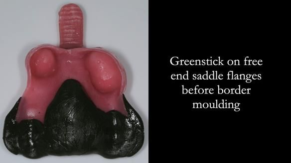 Finlay's Newsletter 59 Ultra hard partial dentures made for Gill