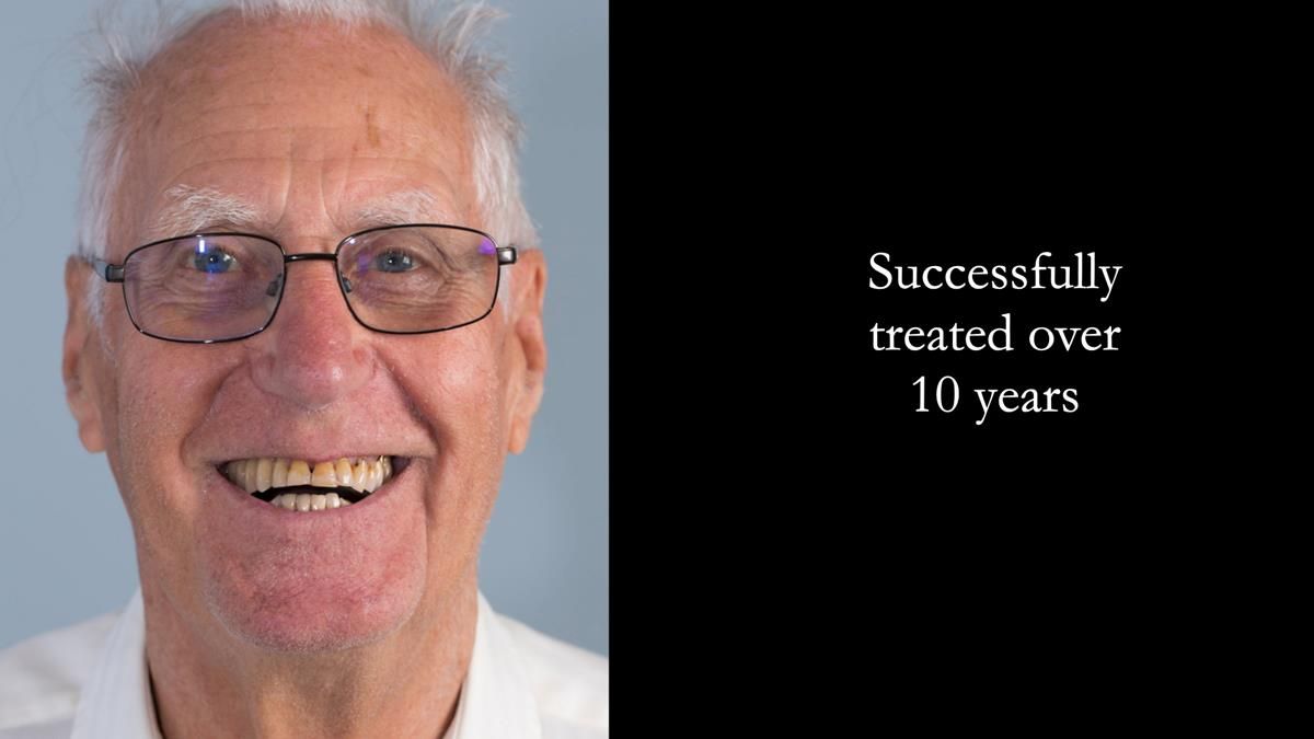 Ken – going downhill, first class