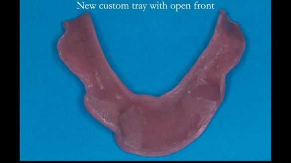 Ken – going downhill, first class