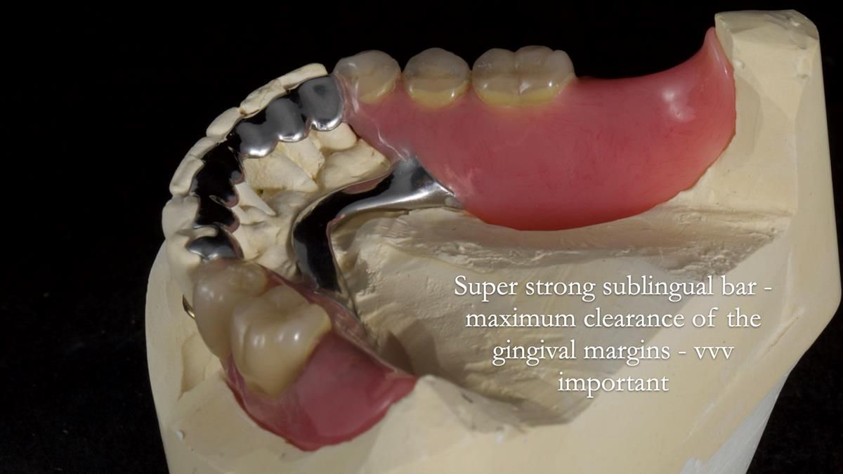 Newsletter 87 – Father Peter: A Partial Denture that needed Minor Miracle