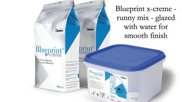 Newsletter 75: Marion’s case - Step-by-step complete denture workflow