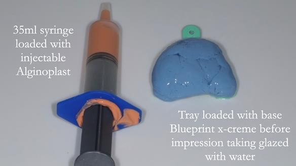 Newsletter 75: Marion’s case - Step-by-step complete denture workflow