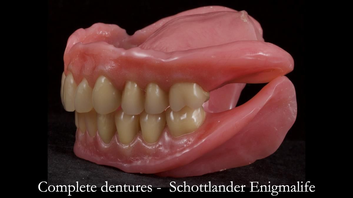 Fin’s Newsletter 88 — Complete dentures - full protocol… he rearranged his own teeth!