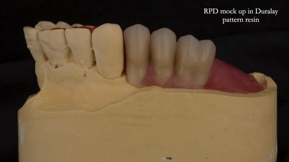 Ken – going downhill, first class