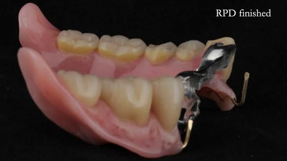 Ken – going downhill, first class