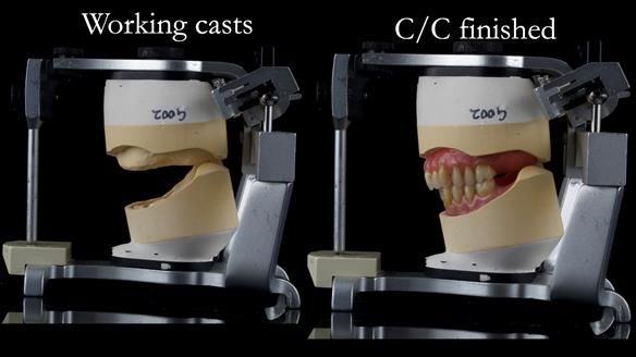 Newsletter 50 Special edition Complete Dentures FULL PROTOCOL