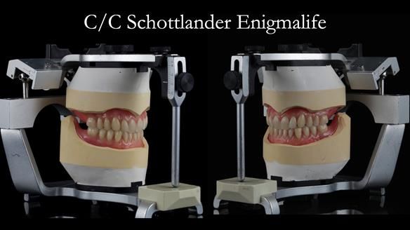 Newsletter 48 Mavis's Complete denture FULL PROTOCOL
