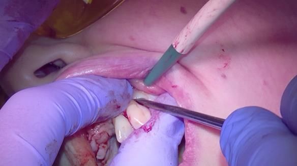 Newsletter 79 – Creating a wonderful smile and changing a life.