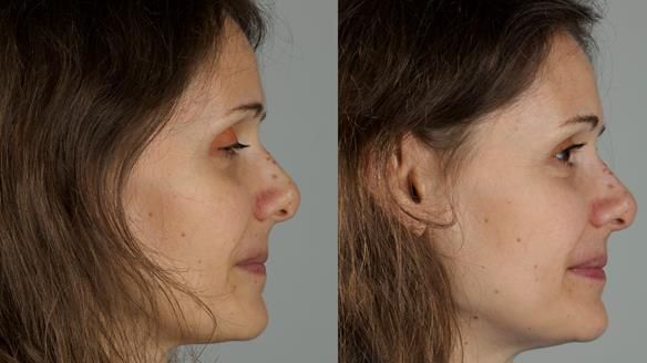 Newsletter 79 – Creating a wonderful smile and changing a life.