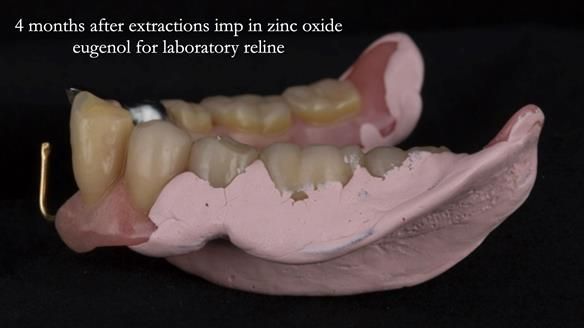 Ken – going downhill, first class