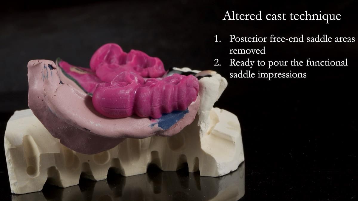 Newsletter 87 – Father Peter: A Partial Denture that needed Minor Miracle