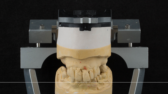 Figure 28 Ideal incisal plane translated to the mounted cast