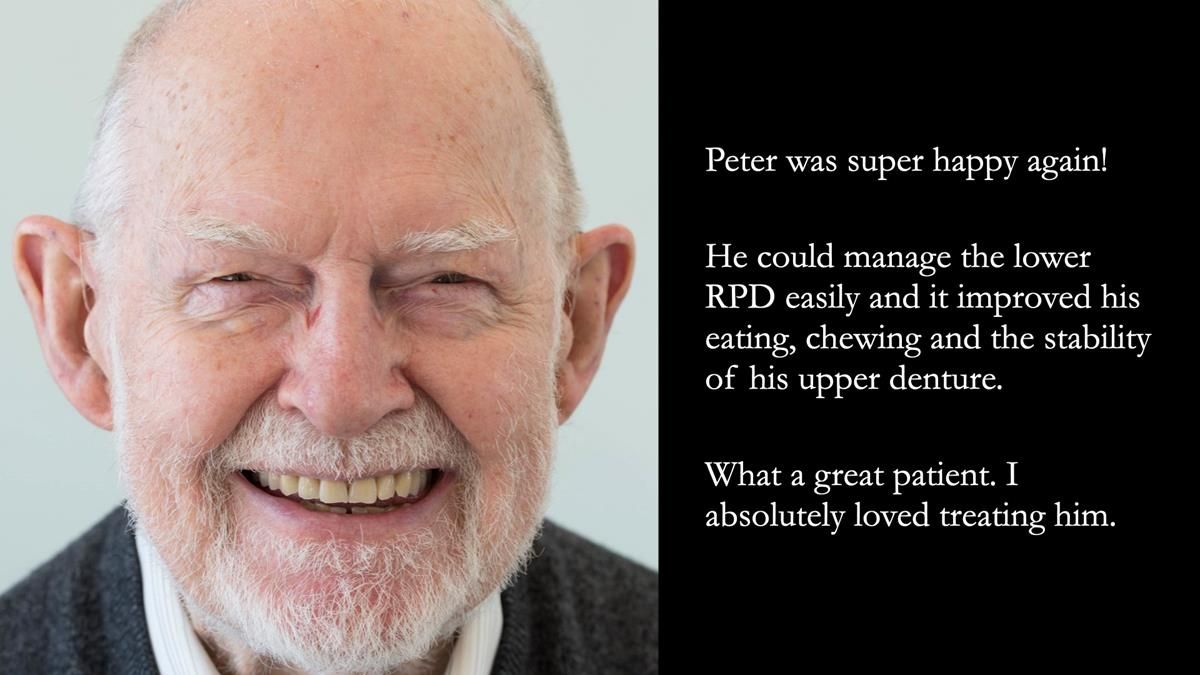 Newsletter 87 – Father Peter: A Partial Denture that needed Minor Miracle