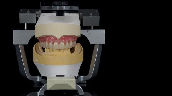 Newsletter 79 – Creating a wonderful smile and changing a life.