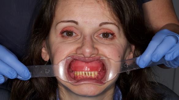 Newsletter 79 – Creating a wonderful smile and changing a life.