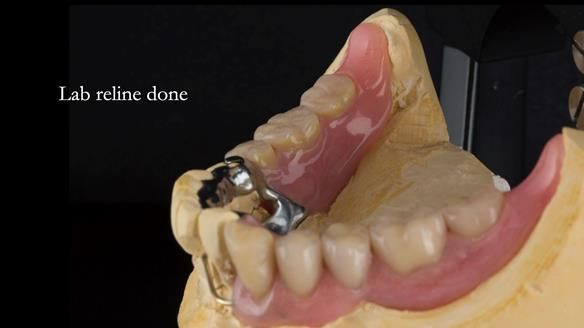 Ken – going downhill, first class