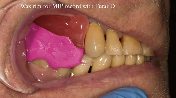 Ken – going downhill, first class