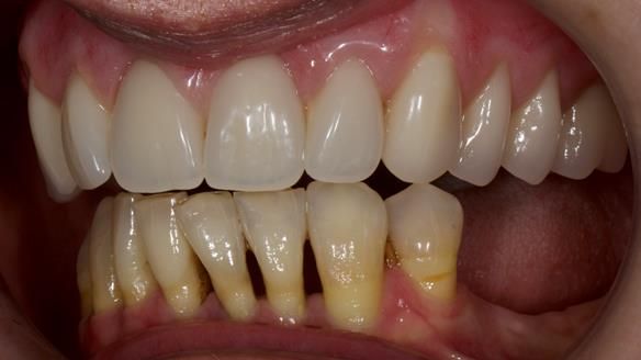 Newsletter 79 – Creating a wonderful smile and changing a life.