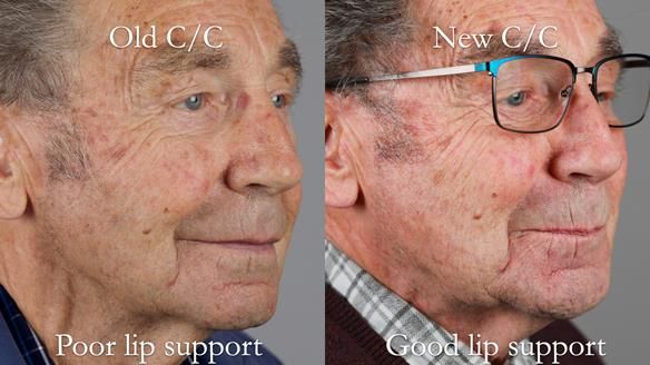 Newsletter 50 Special edition Complete Dentures FULL PROTOCOL