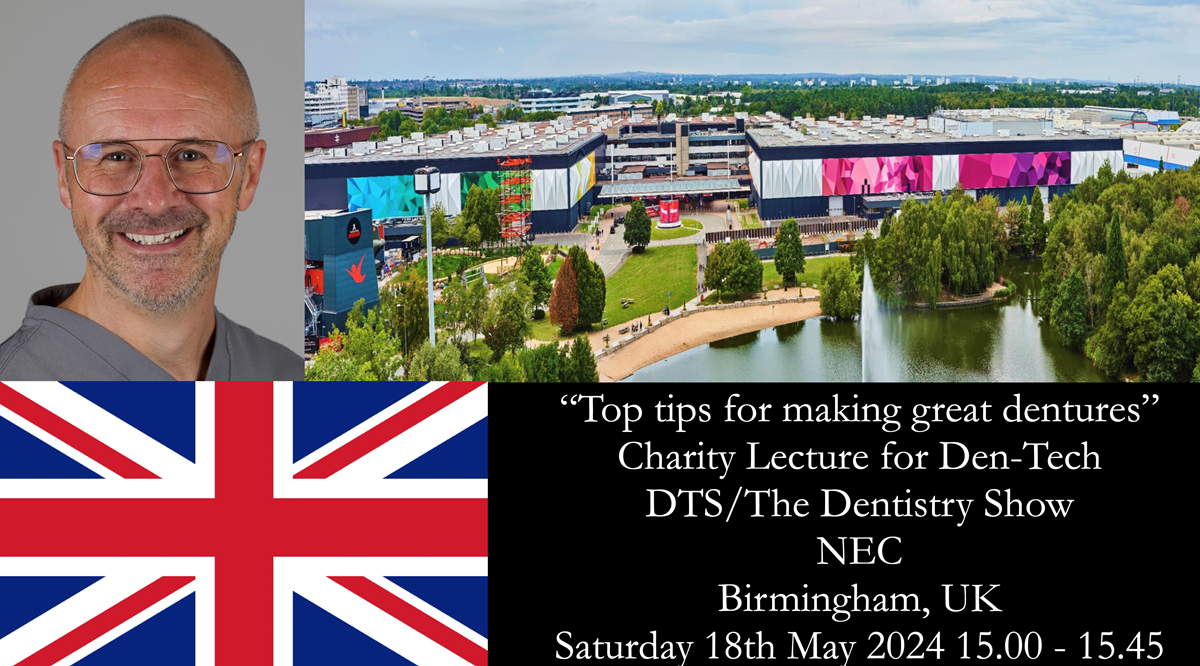 Finlay's Newsletter 60 Sylvia's upper Kennedy Class 2 Mod 1 metal based upper RPD