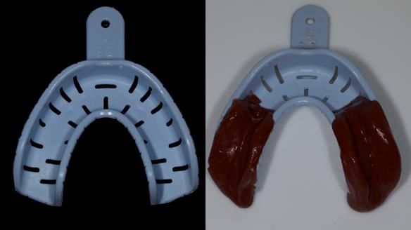 Newsletter 79 – Creating a wonderful smile and changing a life.