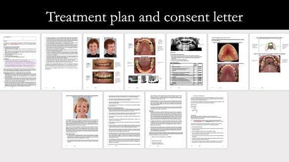 Newsletter 51 Managing Anne’s failing dentition with distal extension base RPD/Splint FULL PROTOCOL