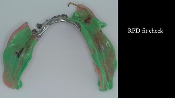 Ken – going downhill, first class