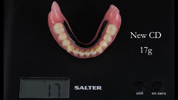 Finlay's Newsletter 62 provision of extractions and metal based complete dentures for Rafique