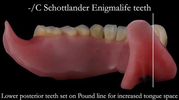 Newsletter 50 Special edition Complete Dentures FULL PROTOCOL