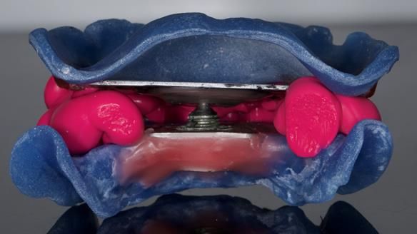 Newsletter 79 – Creating a wonderful smile and changing a life.