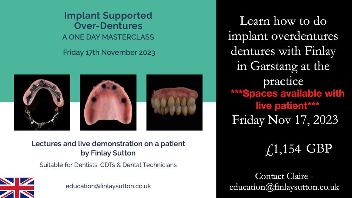 Newsletter 56 showing the making and fitting of a bilateral free end saddle upper removable partial denture (RPD) for patient with pemphigus