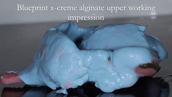 Finlay's Newsletter 60 Sylvia's upper Kennedy Class 2 Mod 1 metal based upper RPD