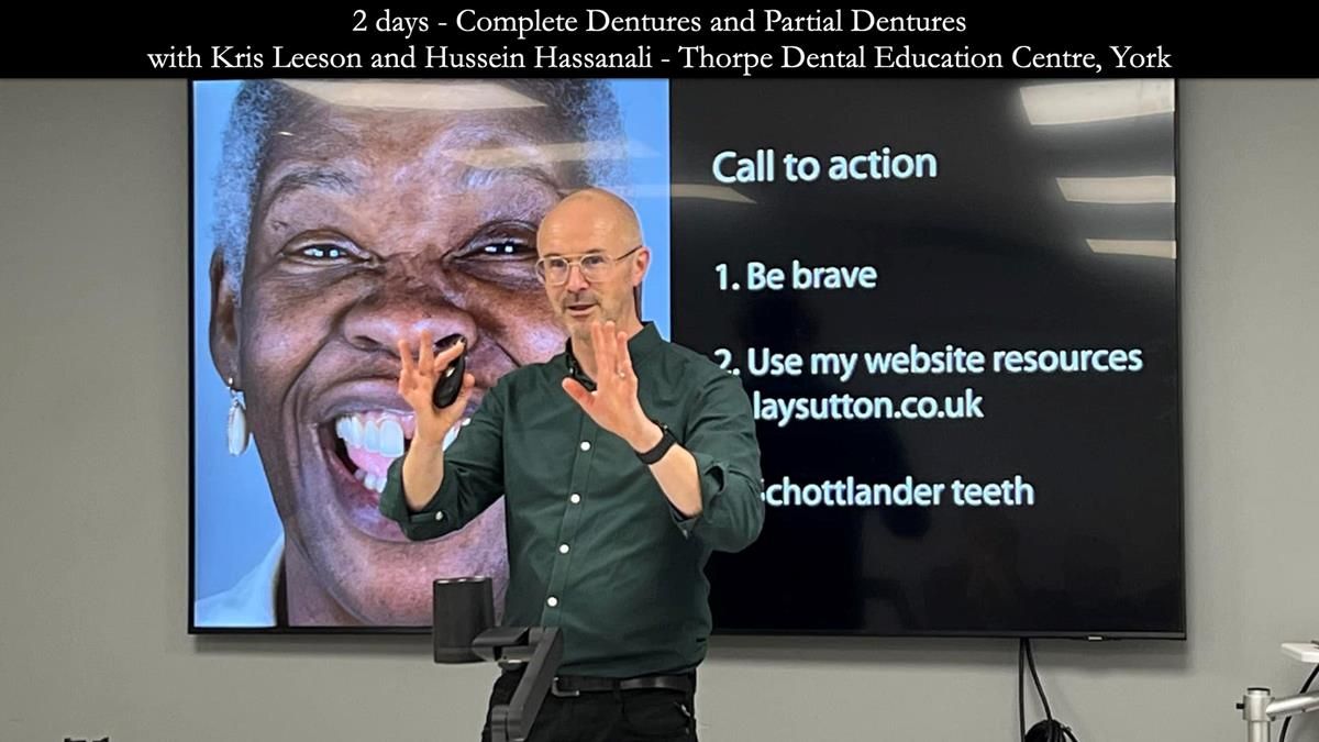 Finlay's Newsletter 59 Ultra hard partial dentures made for Gill