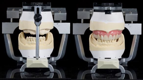 Newsletter 79 – Creating a wonderful smile and changing a life.