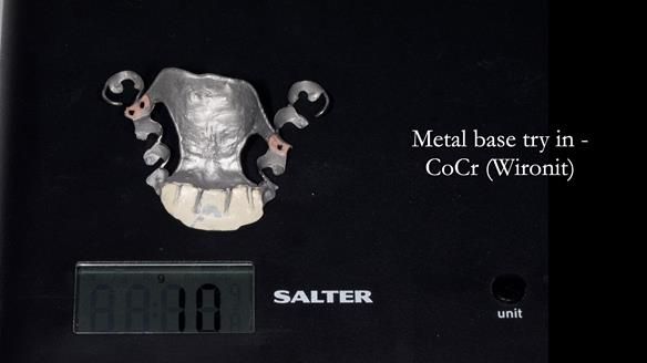 Newsletter 81 - Pam’s Story — how a partial denture changed her life (+ live walkthrough this Thursday)