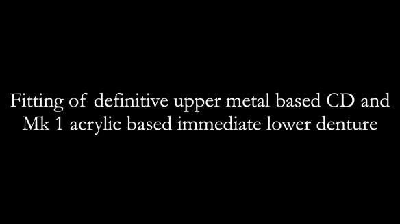 Newsletter 82 Mary - A complete upper and a one-tooth gasket denture