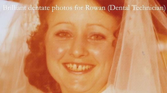 Solving Linda’s Failed “All on 4” implant bridges - full protocol Newsletter 42