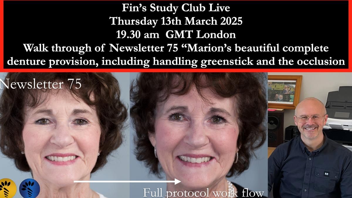 Join me live on Zoom – Thursday 13th March 2025, 19:30 (GMT, London) – for a full step-by-step walkthrough of Marion’s complete dentures, including greenstick handling and occlusion tips: https://us02web.zoom.us/j/86365424669