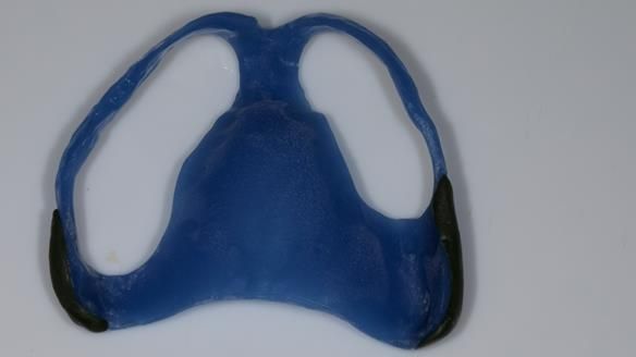 Newsletter 79 – Creating a wonderful smile and changing a life.